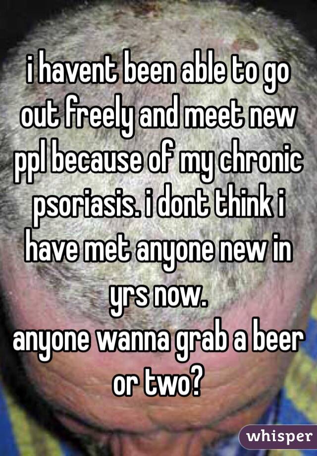i havent been able to go out freely and meet new ppl because of my chronic psoriasis. i dont think i have met anyone new in yrs now. 
anyone wanna grab a beer or two?