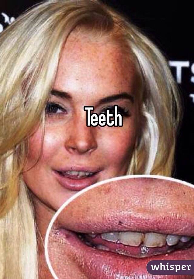 Teeth 