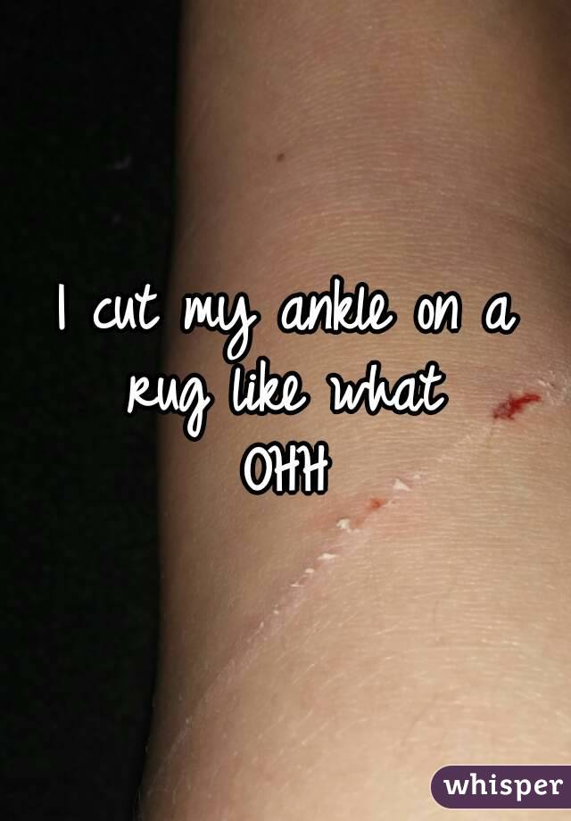 I cut my ankle on a rug like what 
OHH