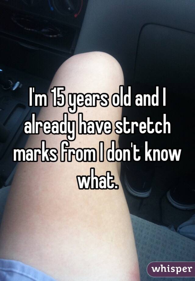 I'm 15 years old and I already have stretch marks from I don't know what. 