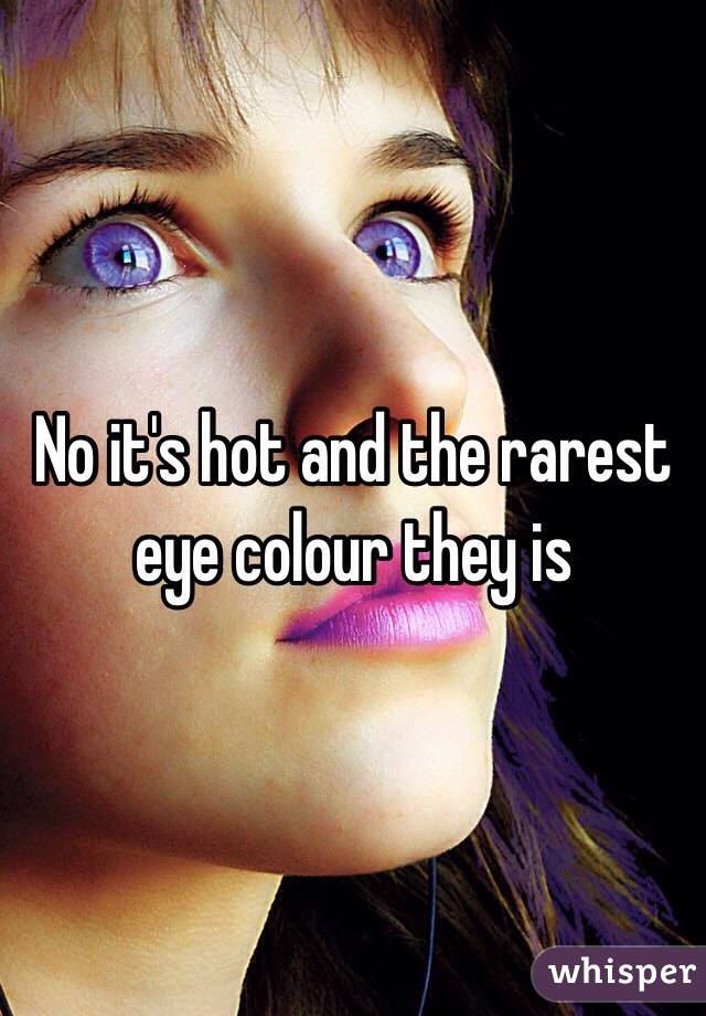 No it's hot and the rarest eye colour they is
