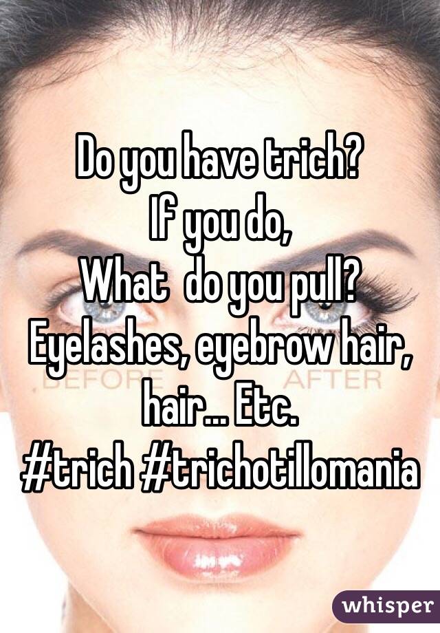 Do you have trich?
If you do,
What  do you pull?
Eyelashes, eyebrow hair, hair... Etc. 
#trich #trichotillomania
