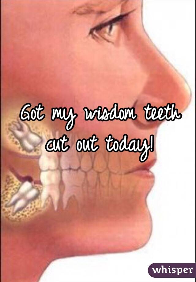 Got my wisdom teeth cut out today!
