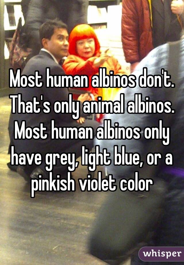 Most human albinos don't. That's only animal albinos. Most human albinos only have grey, light blue, or a pinkish violet color 