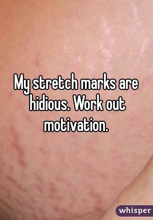 My stretch marks are hidious. Work out motivation. 