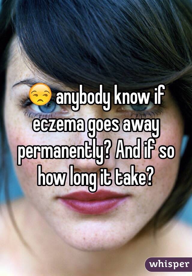 😒 anybody know if eczema goes away permanently? And if so how long it take?