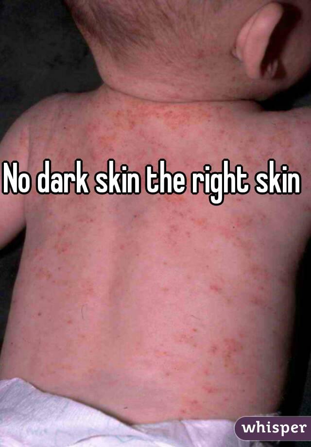 No dark skin the right skin 