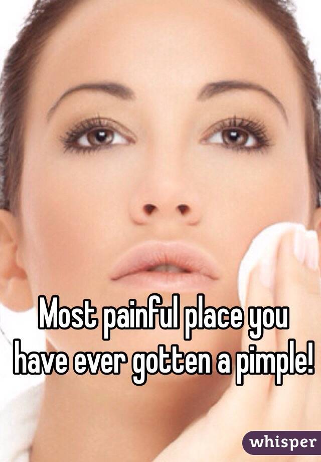 Most painful place you have ever gotten a pimple! 