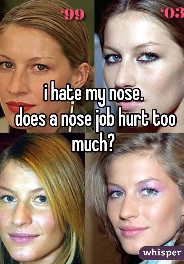 i hate my nose.
 does a nose job hurt too much?