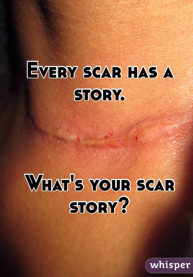 Every scar has a story. 



What's your scar story? 