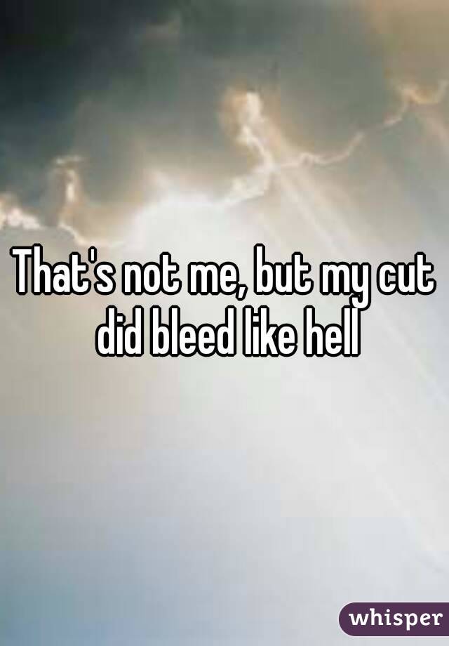 That's not me, but my cut did bleed like hell