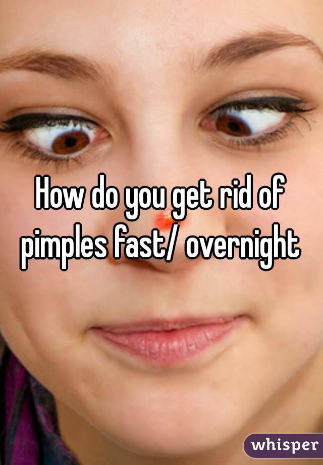 How do you get rid of pimples fast/ overnight 