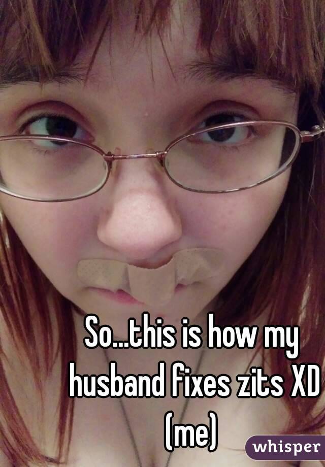 So...this is how my husband fixes zits XD (me) 