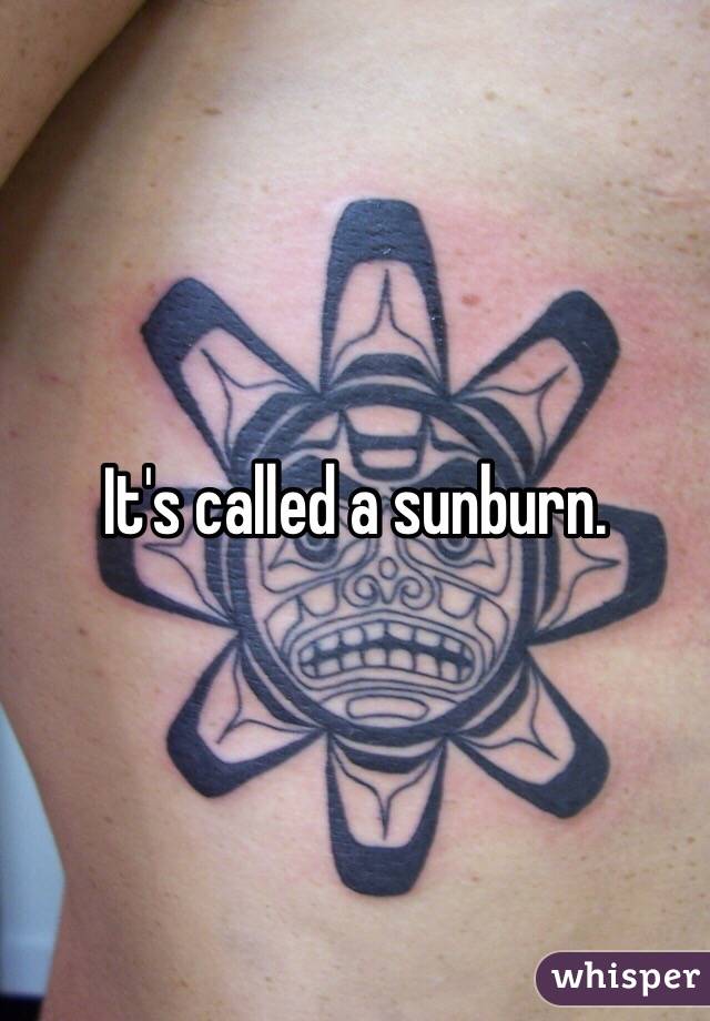 It's called a sunburn. 
