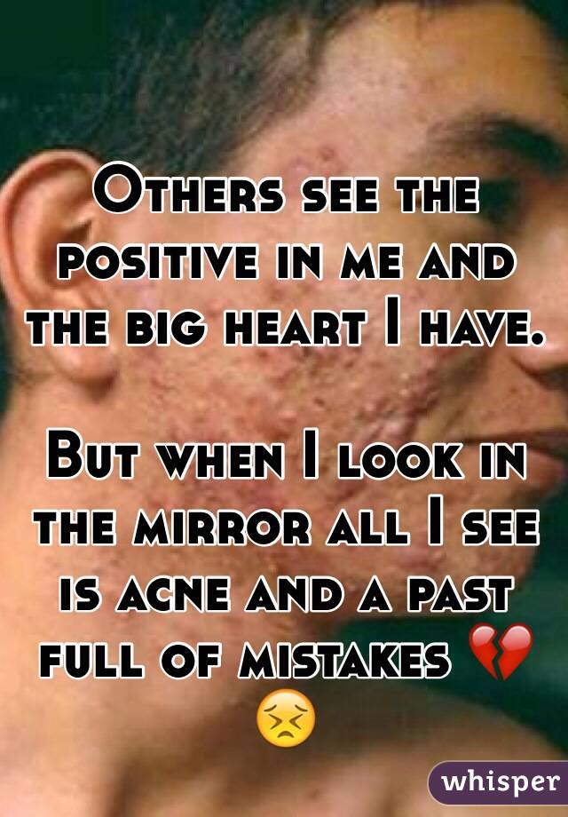 Others see the positive in me and the big heart I have.

But when I look in the mirror all I see is acne and a past full of mistakes 💔😣