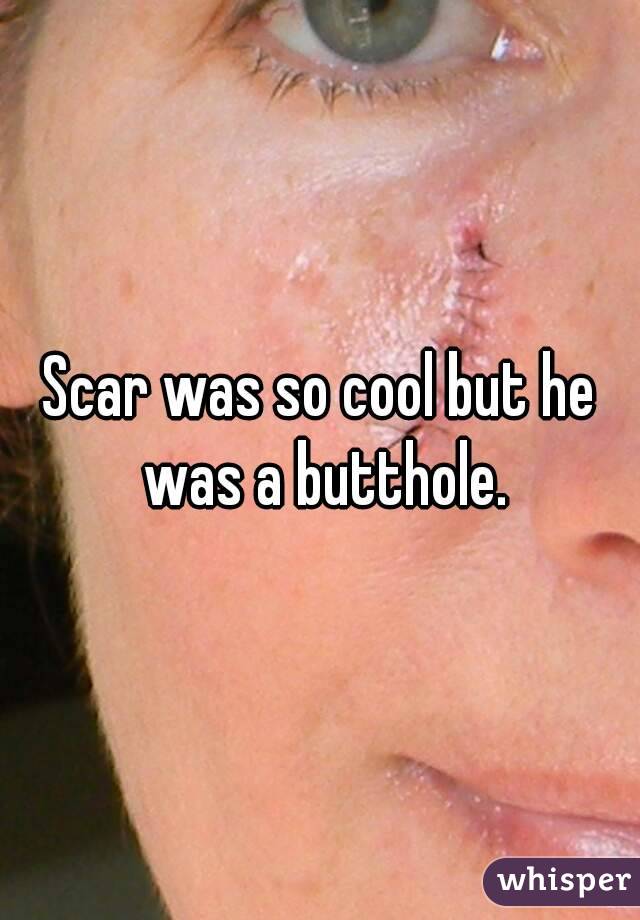 Scar was so cool but he was a butthole.