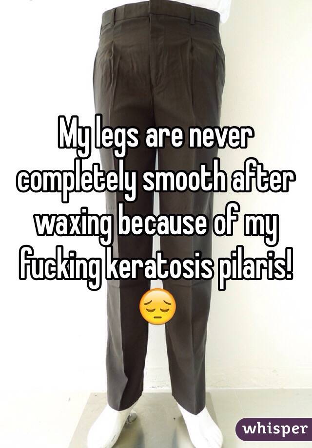My legs are never completely smooth after waxing because of my fucking keratosis pilaris! 😔