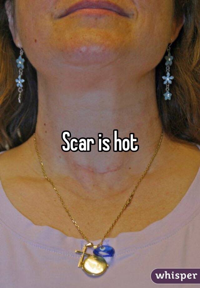 Scar is hot