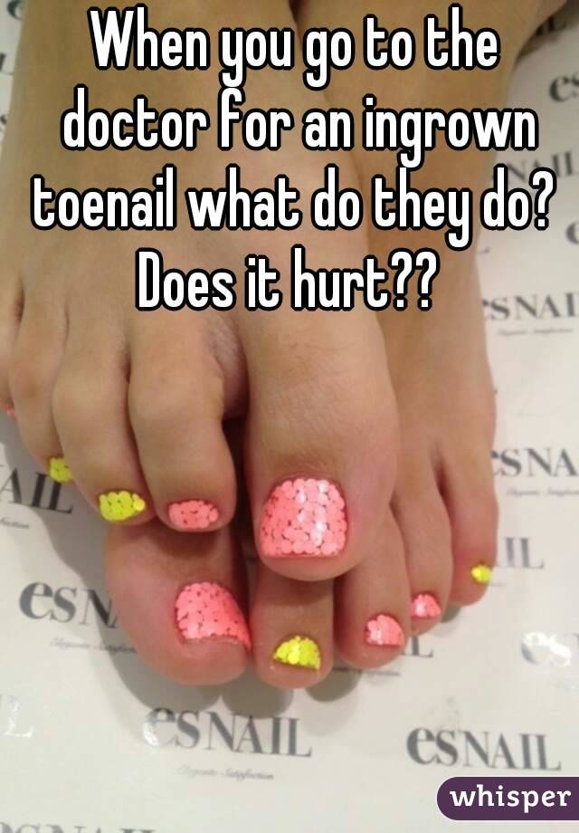 When you go to the doctor for an ingrown toenail what do they do? 
Does it hurt?? 