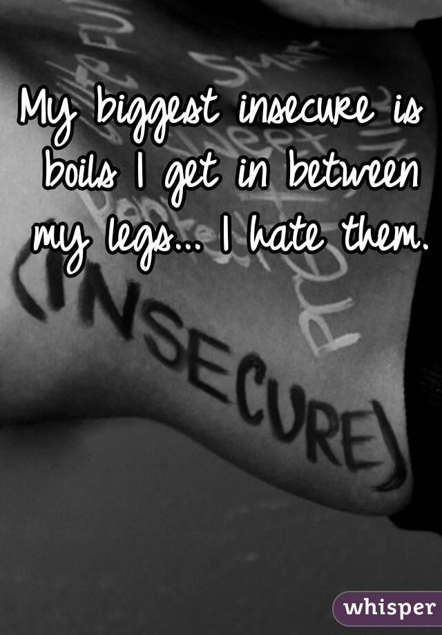 My biggest insecure is boils I get in between my legs... I hate them.