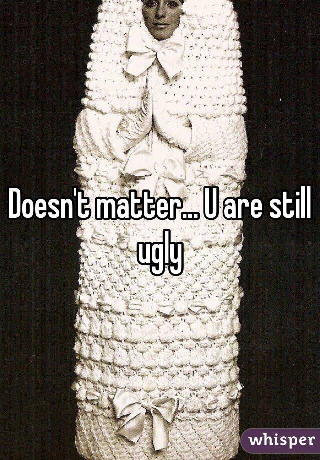 Doesn't matter... U are still ugly