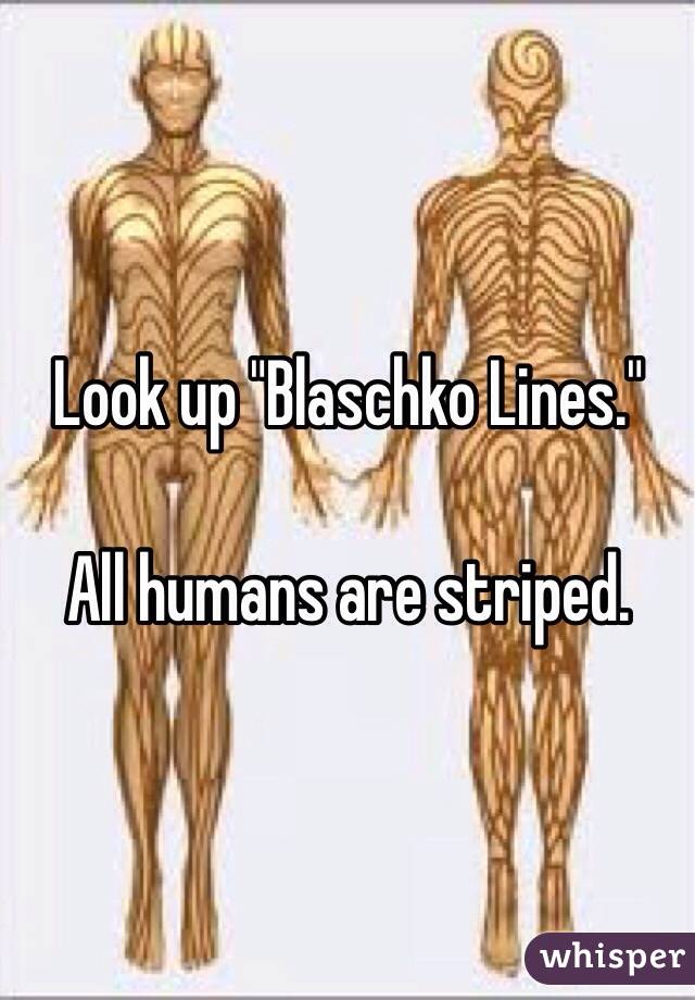 Look up "Blaschko Lines." 

All humans are striped. 