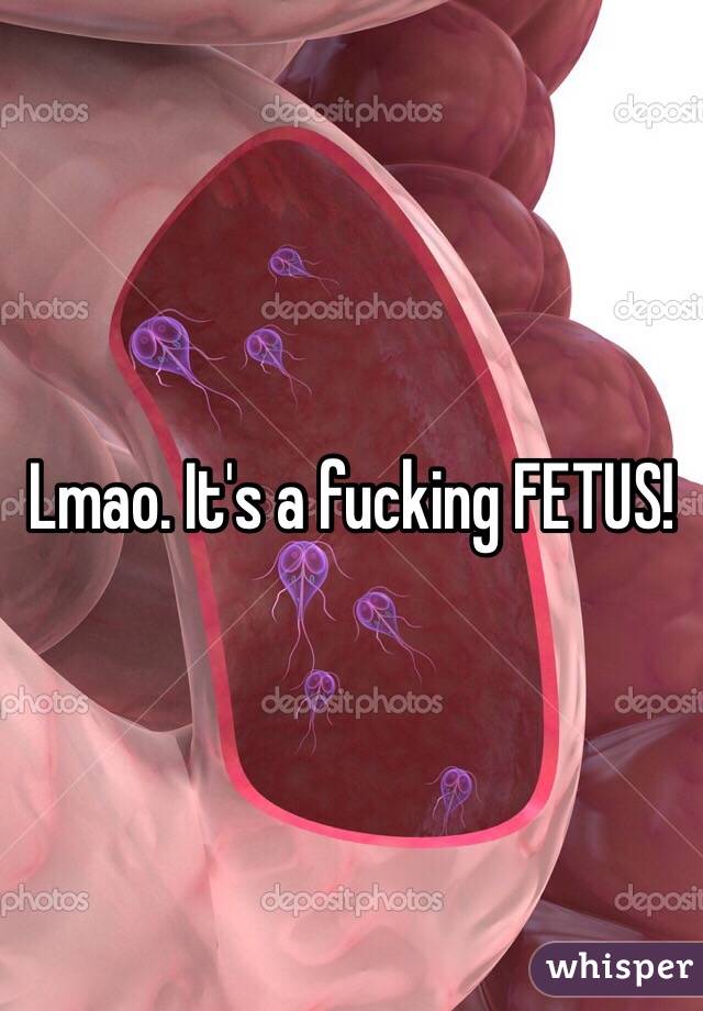 Lmao. It's a fucking FETUS!