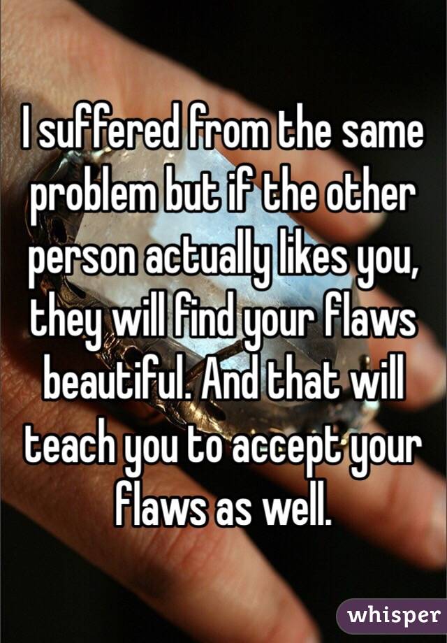 I suffered from the same problem but if the other person actually likes you, they will find your flaws beautiful. And that will teach you to accept your flaws as well.