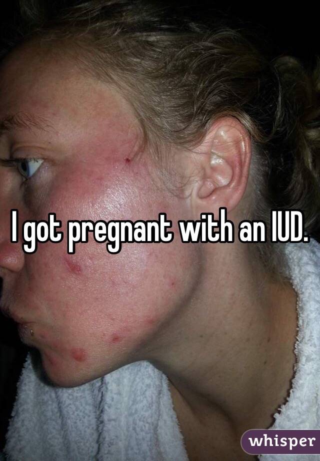 I got pregnant with an IUD. 