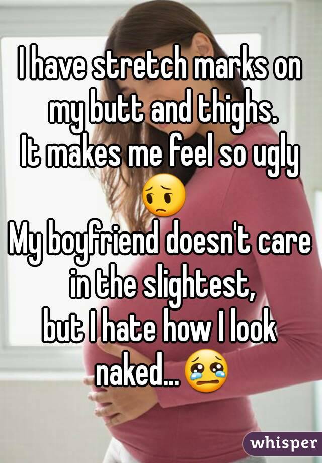 I have stretch marks on my butt and thighs.
It makes me feel so ugly 😔
My boyfriend doesn't care in the slightest,
but I hate how I look naked...😢