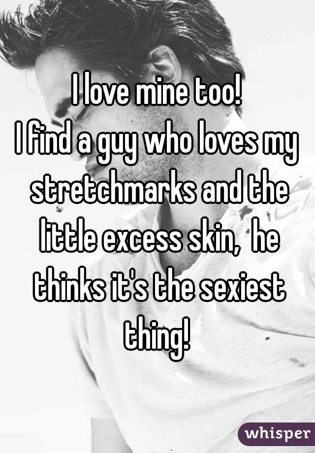 I love mine too!
I find a guy who loves my stretchmarks and the little excess skin,  he thinks it's the sexiest thing! 