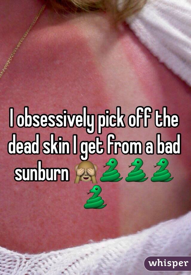 I obsessively pick off the dead skin I get from a bad sunburn 🙈🐍🐍🐍🐍