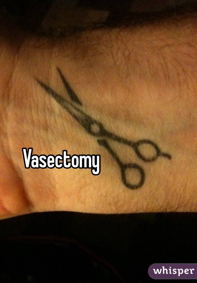 Vasectomy 