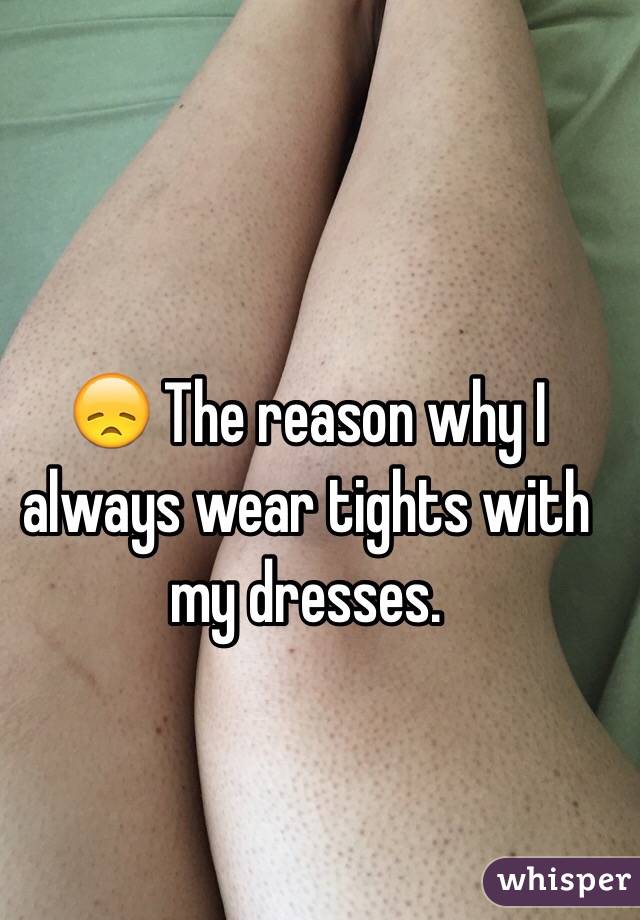 😞 The reason why I always wear tights with my dresses. 