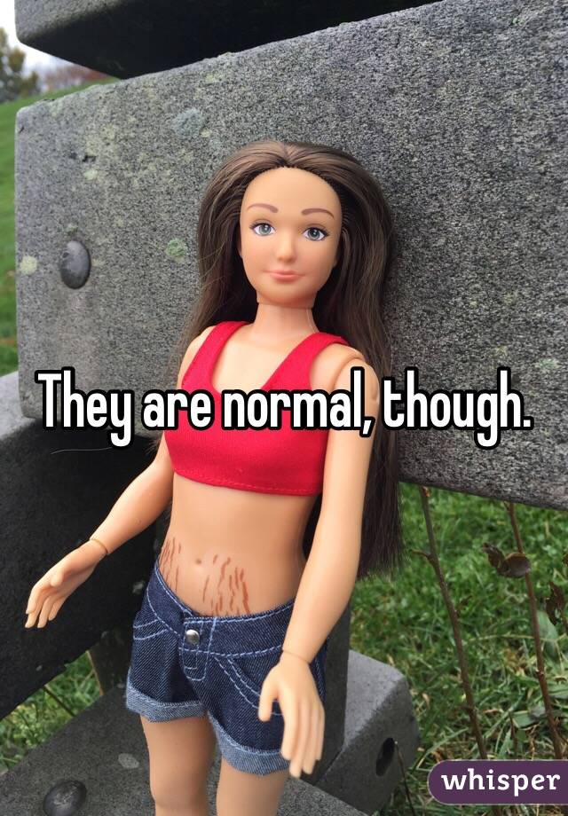 They are normal, though.
