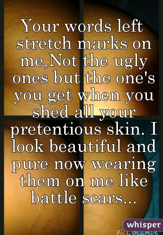 Your words left stretch marks on me,Not the ugly ones but the one's you get when you shed all your pretentious skin. I look beautiful and pure now wearing them on me like battle scars...