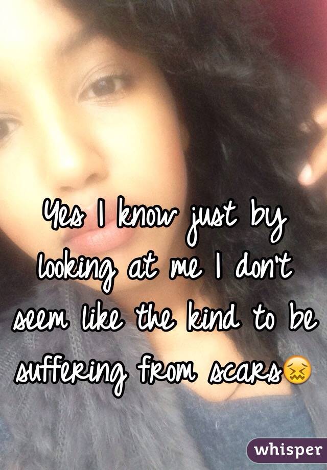 Yes I know just by looking at me I don't seem like the kind to be suffering from scarsðŸ˜–