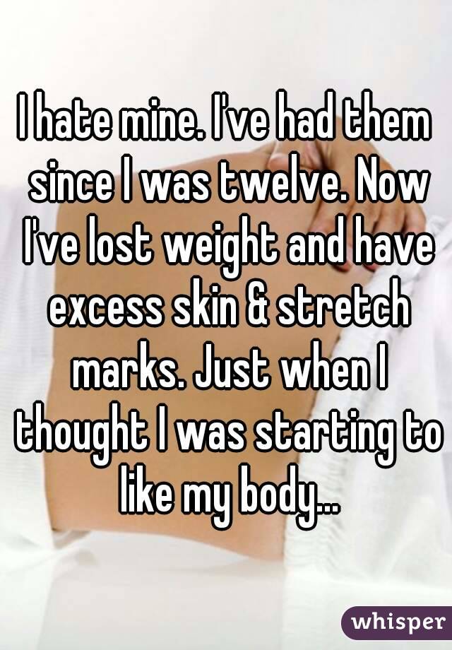 I hate mine. I've had them since I was twelve. Now I've lost weight and have excess skin & stretch marks. Just when I thought I was starting to like my body...