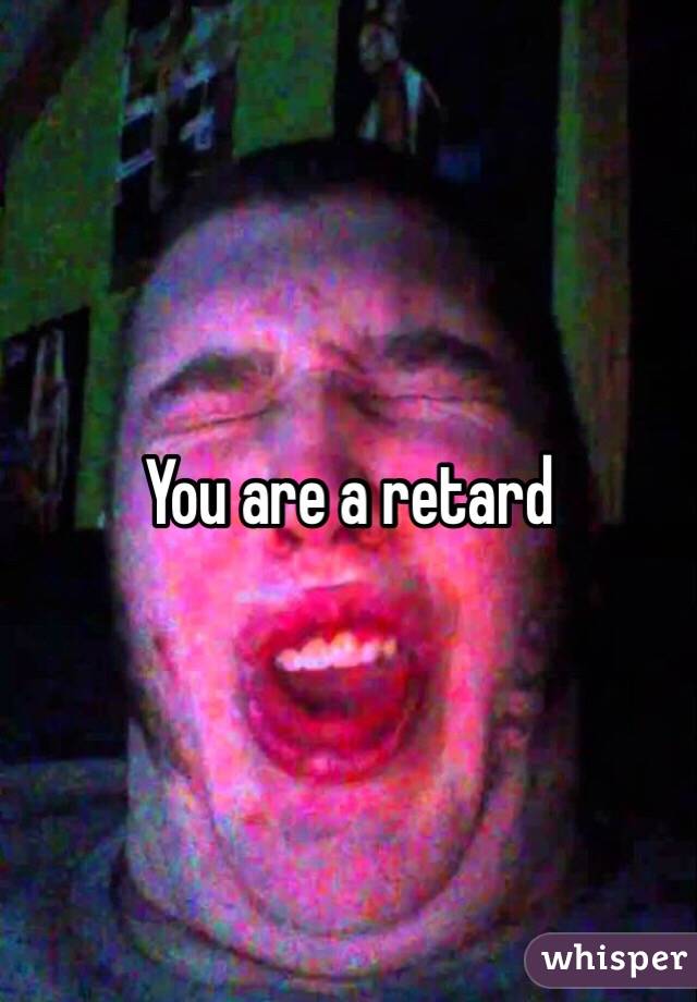 You are a retard 
