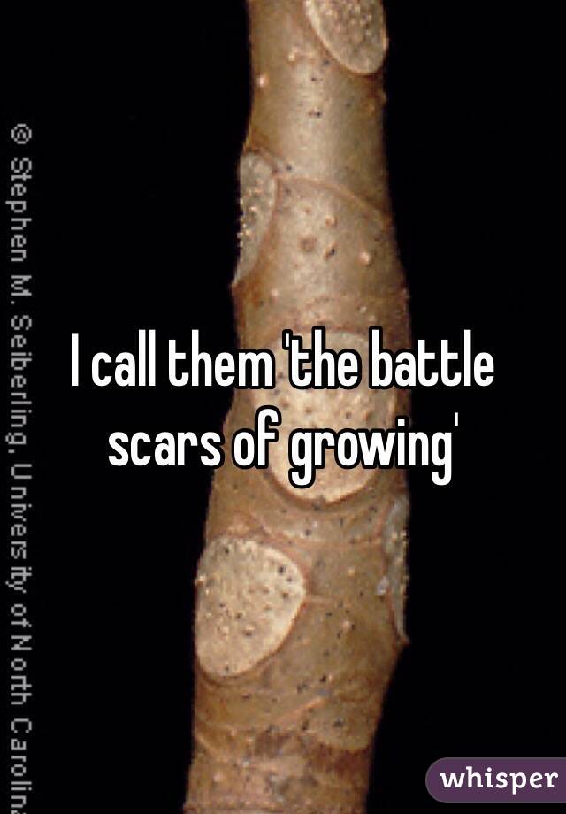 I call them 'the battle scars of growing'