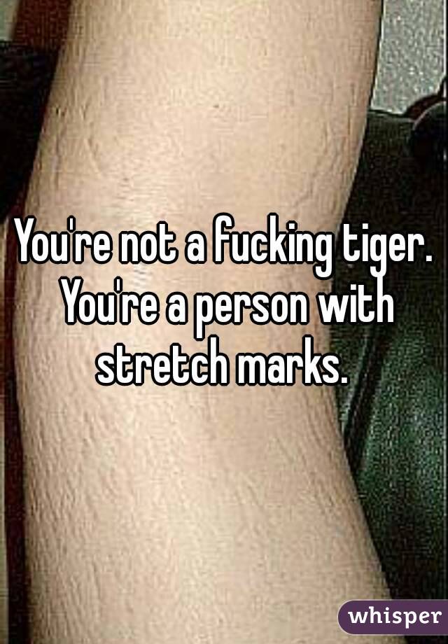 You're not a fucking tiger. You're a person with stretch marks. 