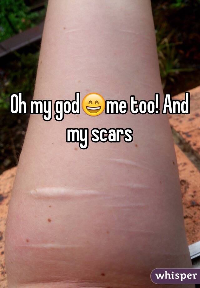 Oh my god😄me too! And my scars 