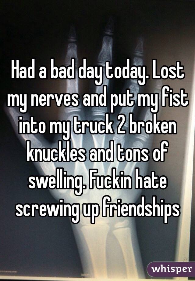 Had a bad day today. Lost my nerves and put my fist into my truck 2 broken knuckles and tons of swelling. Fuckin hate screwing up friendships