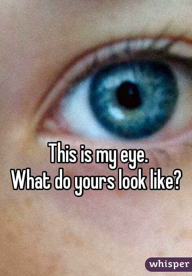 


This is my eye.
What do yours look like? 