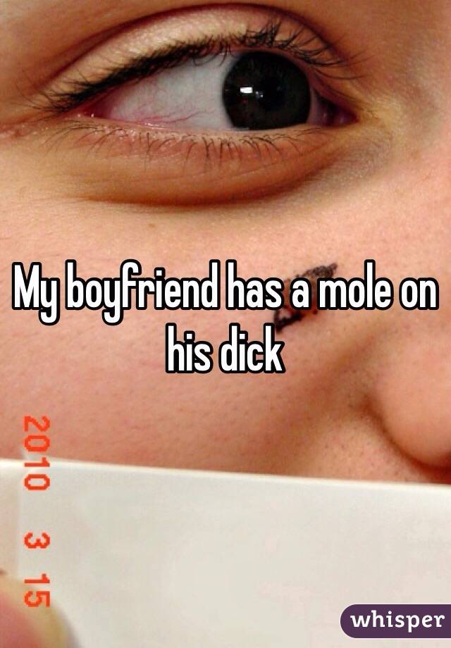 My boyfriend has a mole on his dick 