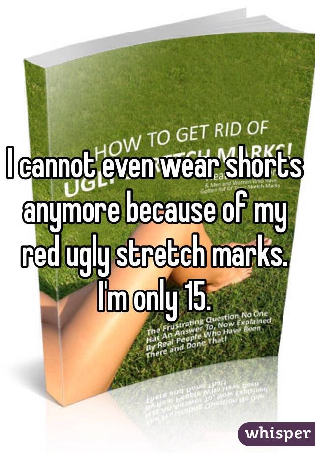 I cannot even wear shorts anymore because of my red ugly stretch marks. I'm only 15.
