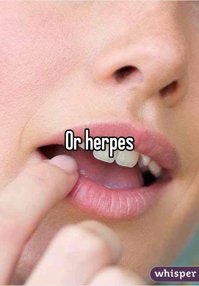 Or herpes