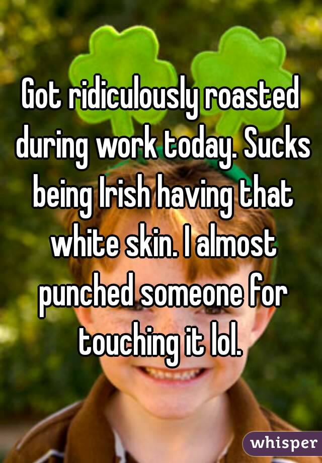 Got ridiculously roasted during work today. Sucks being Irish having that white skin. I almost punched someone for touching it lol. 