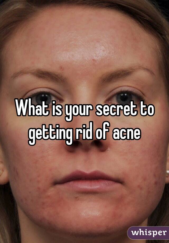 What is your secret to getting rid of acne