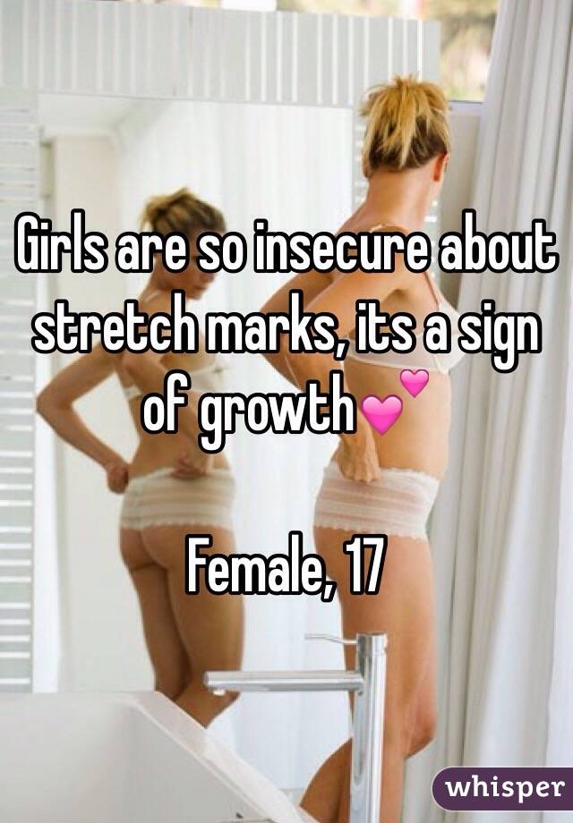 Girls are so insecure about stretch marks, its a sign of growth💕

Female, 17
